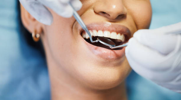 Best Emergency Dental Care for Broken or Chipped Teeth in Melody Hill, IN